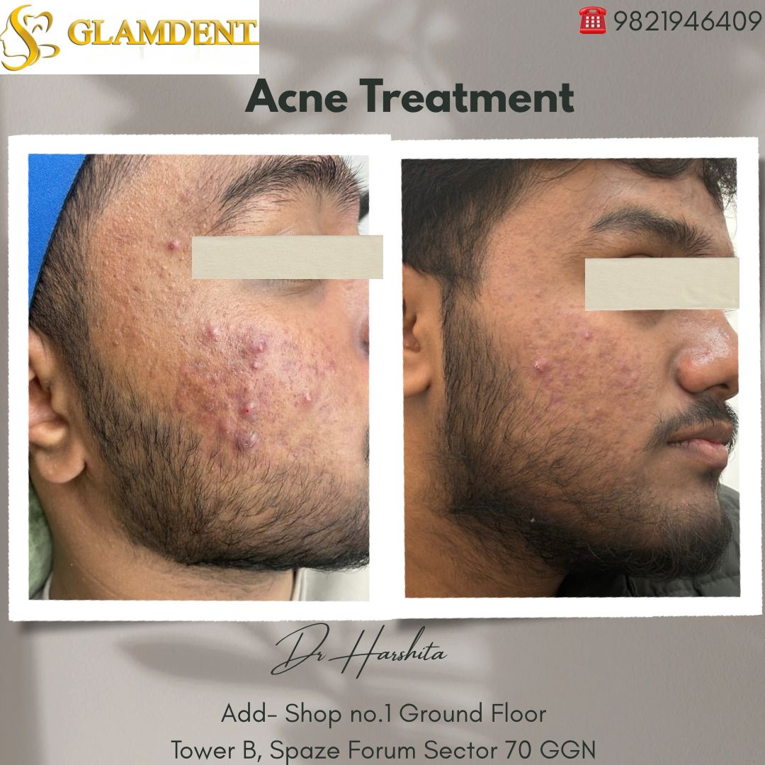 Treatment Picutres