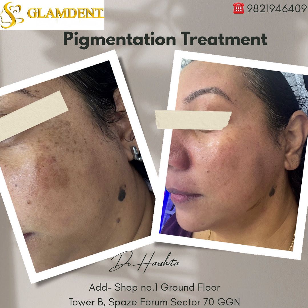 Treatment Picutres