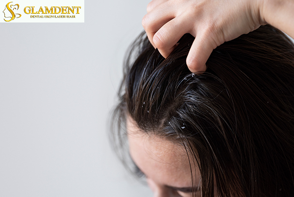 Hair Dandruff Treatment