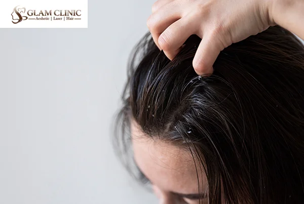 Hair Dandruff Treatment