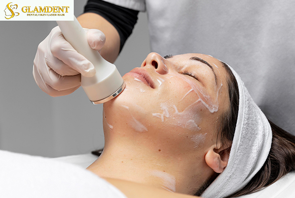 Chemical Peels