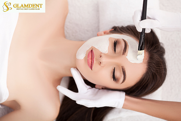 Photo Facial