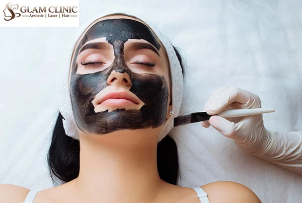 Carbon Facial