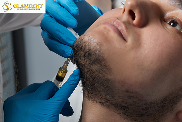 PRP Treatment