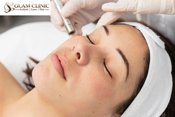 Freckle Removal