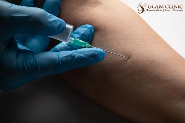 NCTF Treatment