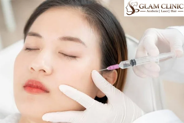 Facial Fillers