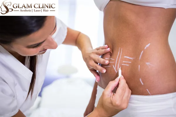 Body Contouring with Fillers