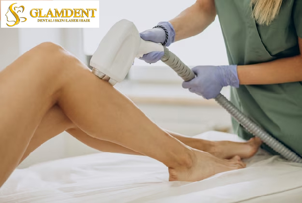 Laser Treatment